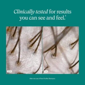 does nutrafol work